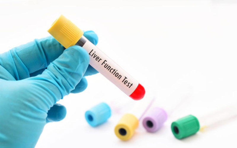 ทำไมต้อง ตรวจสุขภาพประจำปี ?