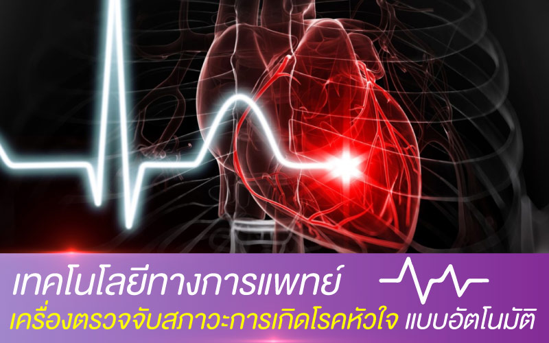 เทคโนโลยีทางการแพทย์ เครื่องตรวจจับสภาวะการเกิดโรคหัวใจ แบบอัตโนมัติ