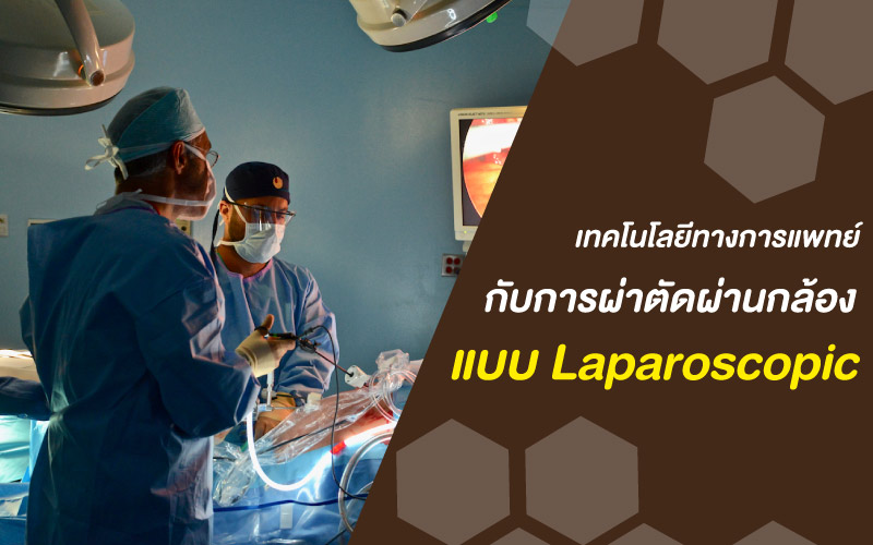 เทคโนโลยีทางการแพทย์ กับการผ่าตัดผ่านกล้องแบบ Laparoscopic