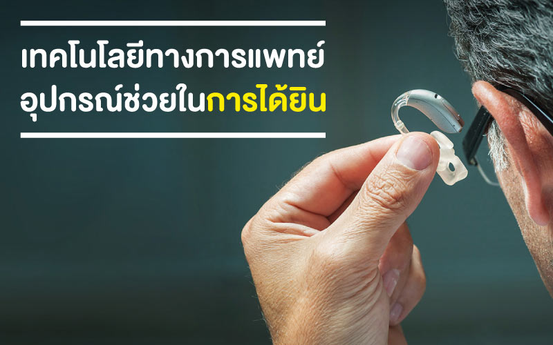 เทคโนโลยีทางการแพทย์ อุปกรณ์ช่วยในการได้ยิน ที่เป็นของการพัฒนา