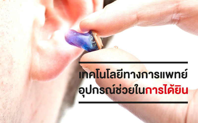 เทคโนโลยีทางการแพทย์ อุปกรณ์ช่วยในการได้ยิน ที่เป็นของการพัฒนา
