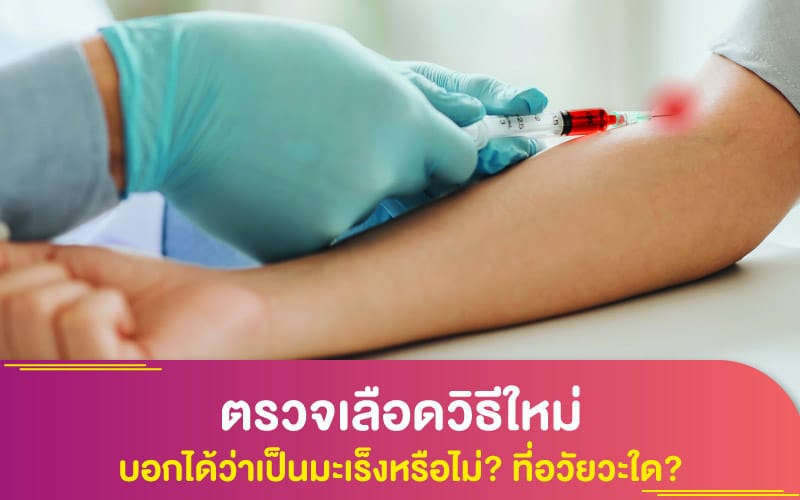 ตรวจเลือดวิธีใหม่ บอกได้ว่าเป็นมะเร็งหรือไม่? ที่อวัยวะใด?