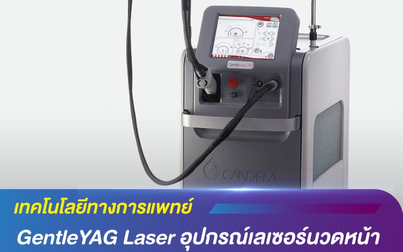 เทคโนโลยีทางการแพทย์ GentleYAG Laser อุปกรณ์เลเซอร์นวดหน้า