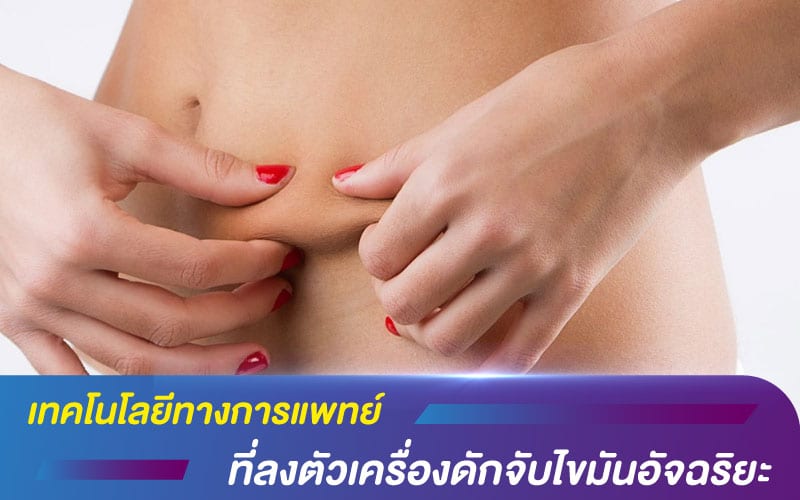 เทคโนโลยีทางการแพทย์ ที่ลงตัวเครื่องดักจับไขมันอัจฉริยะ