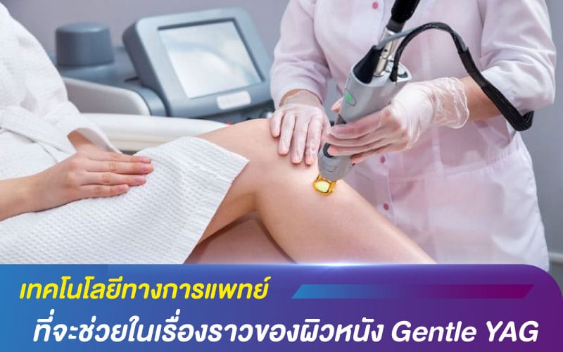 เทคโนโลยีทางการแพทย์ ที่จะช่วยในเรื่องราวของผิวหนัง Gentle YAG