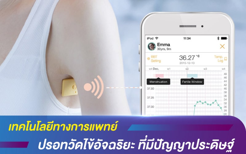 เทคโนโลยีทางการแพทย์ กับปรอทวัดไข้อัจฉริยะ ที่มีปัญญาประดิษฐ์