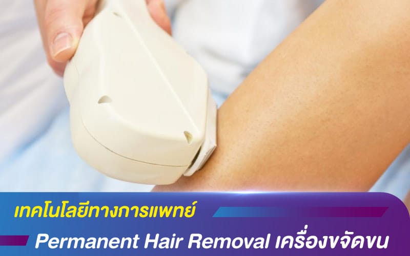 เทคโนโลยีทางการแพทย์ Permanent Hair Removal เครื่องขจัดขน